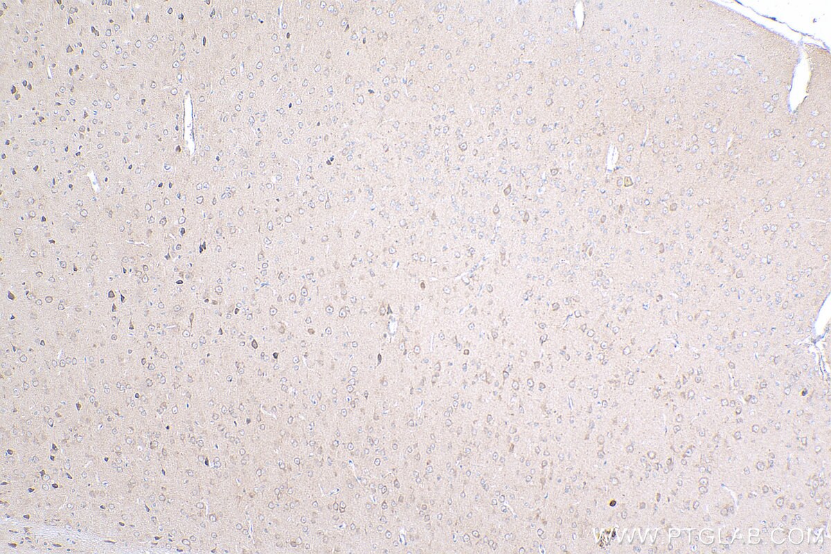 Immunohistochemistry (IHC) staining of mouse brain tissue using NMDAR1 Polyclonal antibody (27232-1-AP)