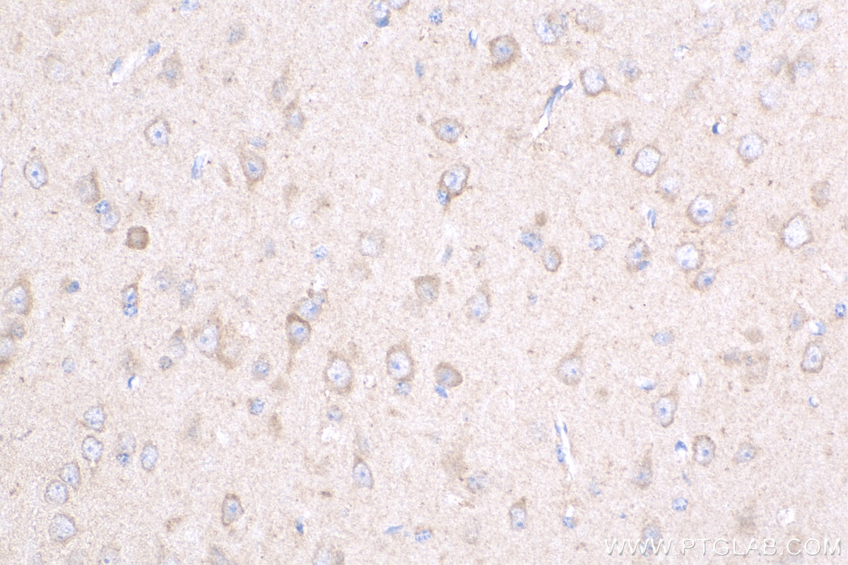 Immunohistochemistry (IHC) staining of mouse brain tissue using NMDAR1 Polyclonal antibody (27232-1-AP)