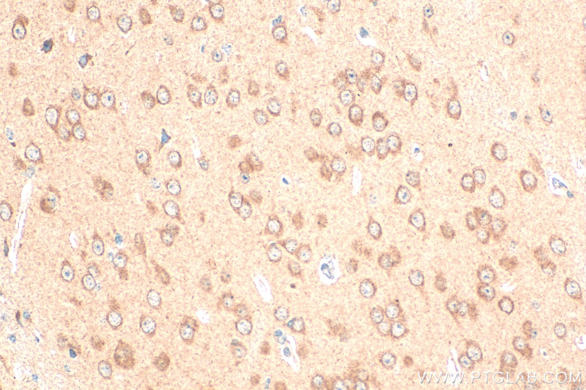 Immunohistochemistry (IHC) staining of mouse brain tissue using NMDAR1/GRIN1 Polyclonal antibody (27232-1-AP)