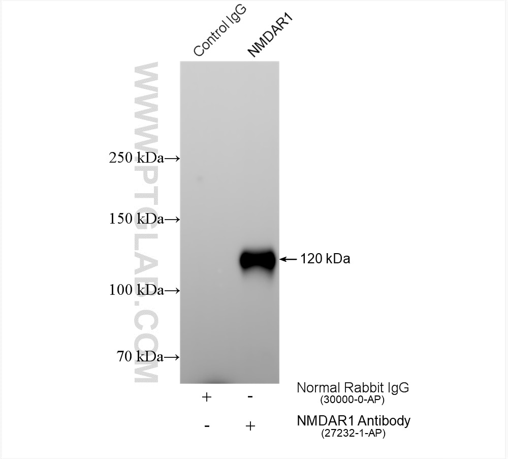 Immunoprecipitation (IP) experiment of rat brain tissue using NMDAR1 Polyclonal antibody (27232-1-AP)