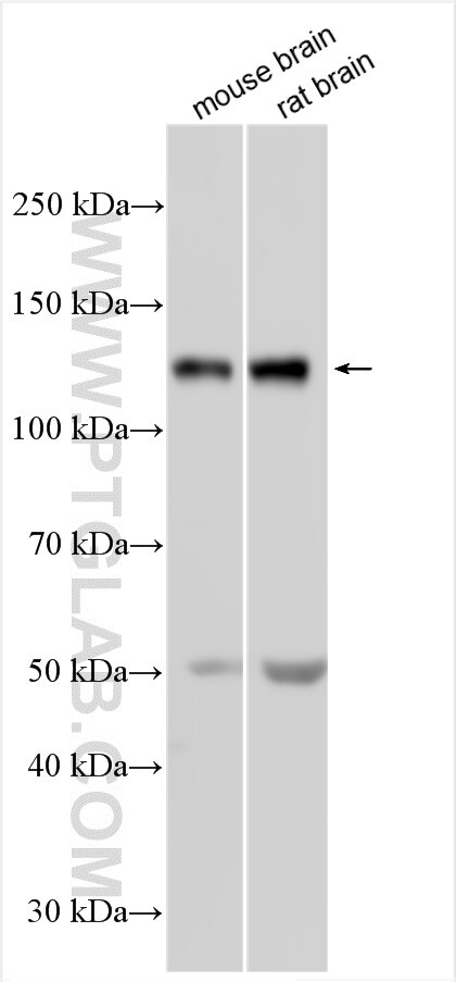 Western Blot (WB) analysis of various lysates using NMDAR1/GRIN1 Polyclonal antibody (27232-1-AP)