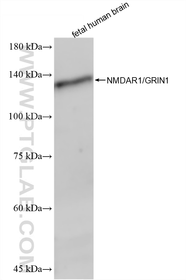 Western Blot (WB) analysis of fetal human brain tissue using NMDAR1/GRIN1 Recombinant monoclonal antibody (85973-3-RR)