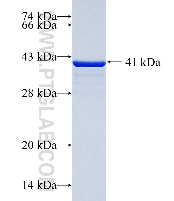 NMDAR2A/GRIN2A fusion protein Ag29423 SDS-PAGE