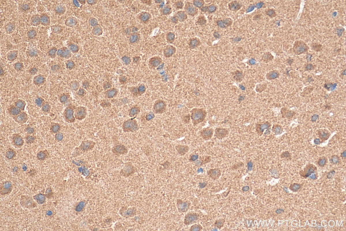 Immunohistochemistry (IHC) staining of mouse brain tissue using NMDAR2A/GRIN2A Polyclonal antibody (28525-1-AP)