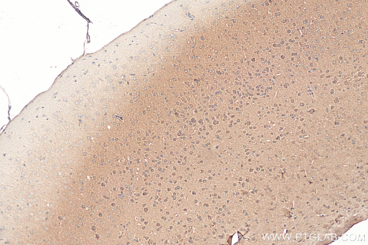 Immunohistochemistry (IHC) staining of mouse brain tissue using NMDAR2A/GRIN2A Polyclonal antibody (28525-1-AP)