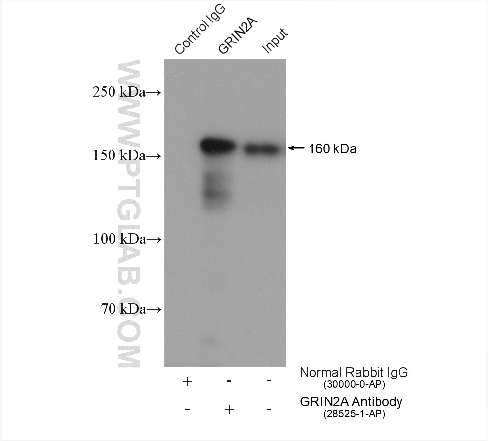 Immunoprecipitation (IP) experiment of rat brain tissue using NMDAR2A/GRIN2A Polyclonal antibody (28525-1-AP)