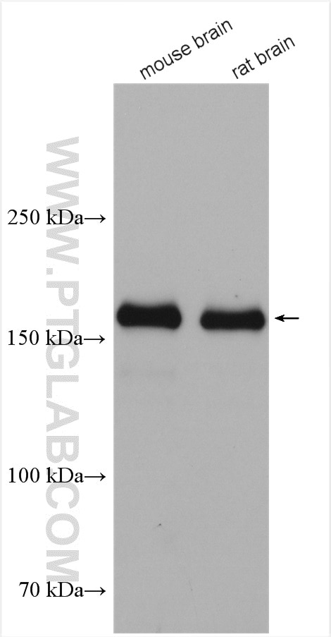Western Blot (WB) analysis of various lysates using NMDAR2A/GRIN2A Polyclonal antibody (28525-1-AP)