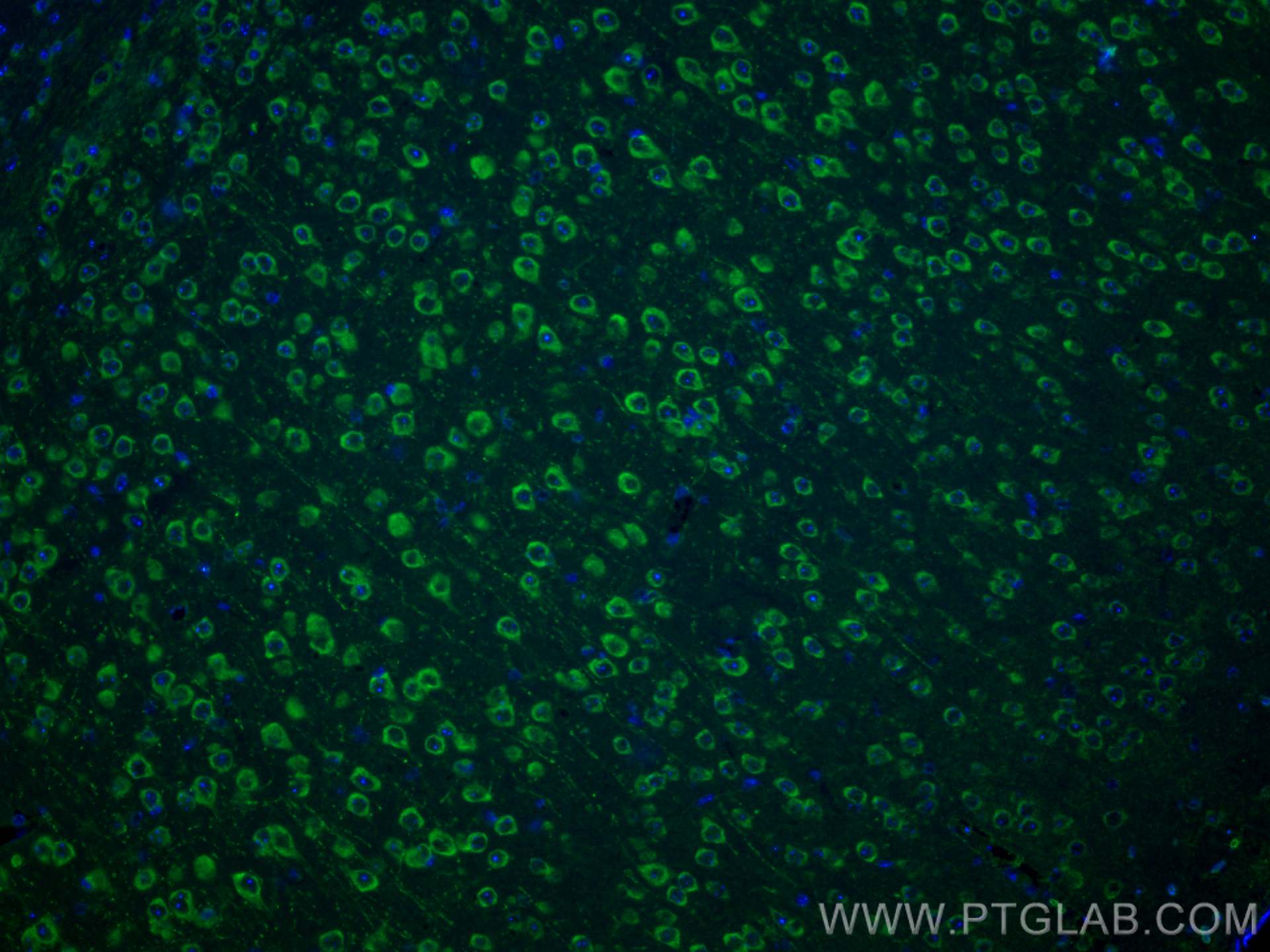 Immunofluorescence (IF) / fluorescent staining of mouse brain tissue using NMDAR2A/GRIN2A Polyclonal antibody (28571-1-AP)
