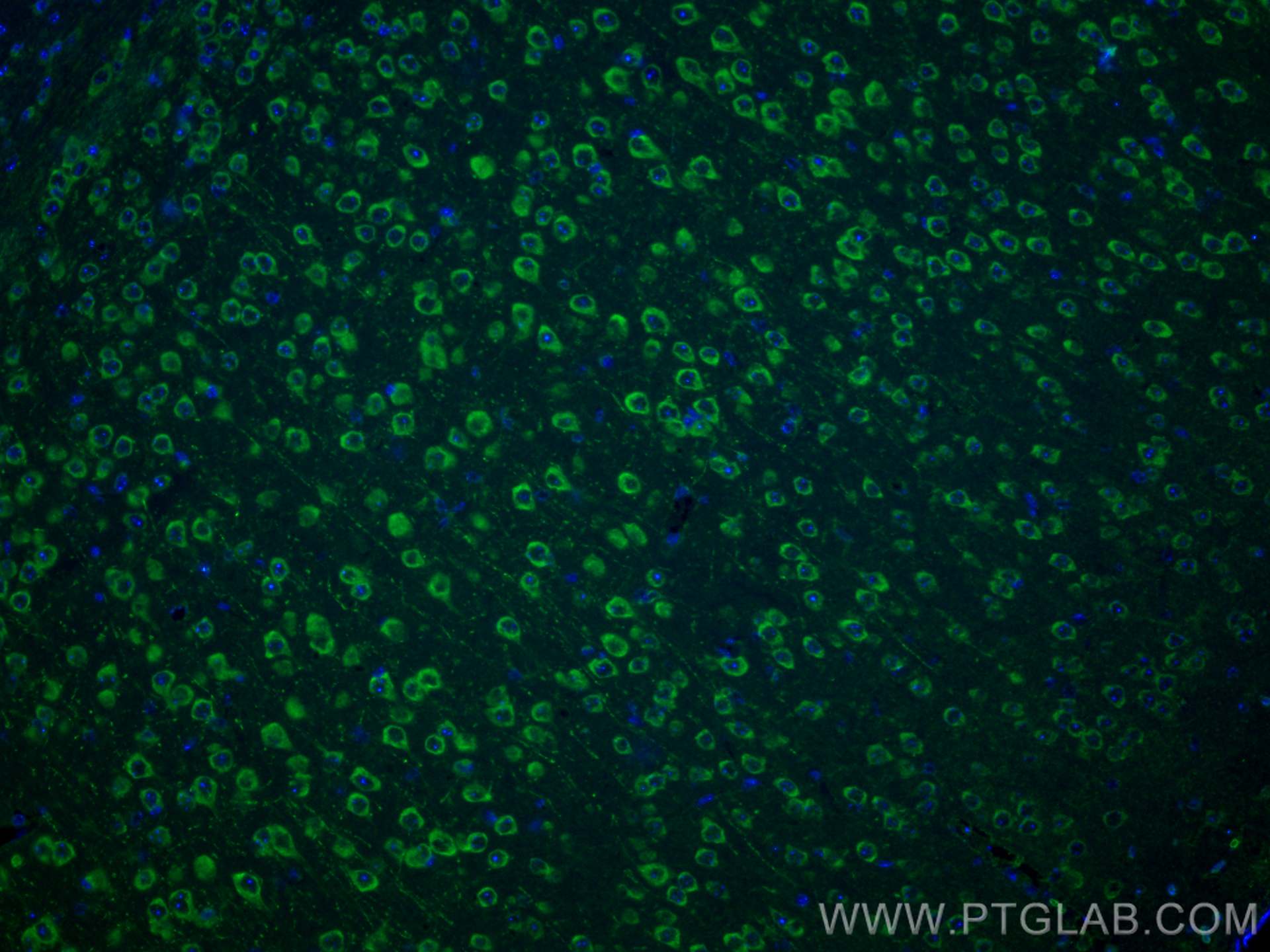 Immunofluorescence (IF) / fluorescent staining of mouse brain tissue using NMDAR2A/GRIN2A Polyclonal antibody (28571-1-AP)