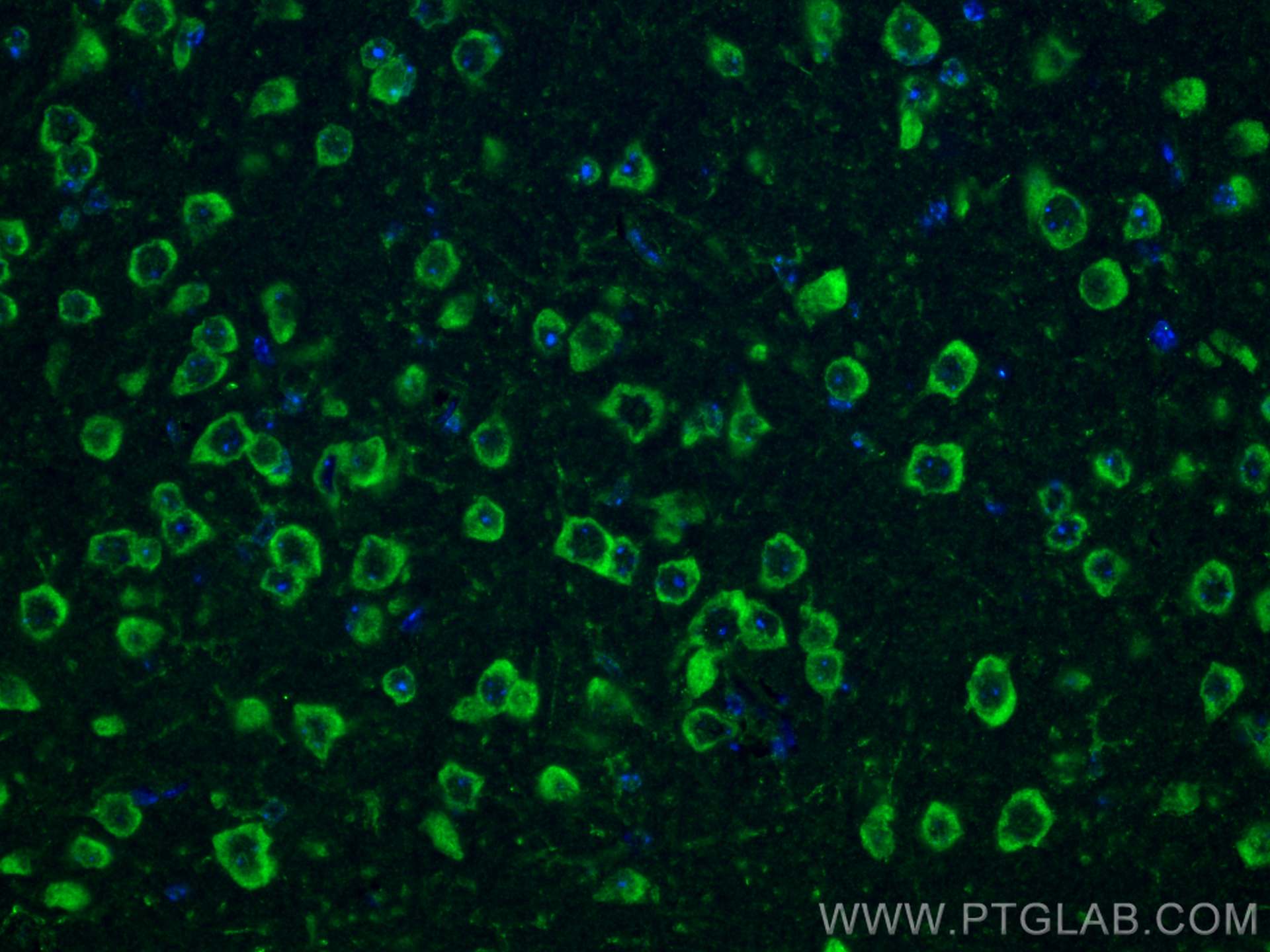 Immunofluorescence (IF) / fluorescent staining of mouse brain tissue using NMDAR2A/GRIN2A Polyclonal antibody (28571-1-AP)