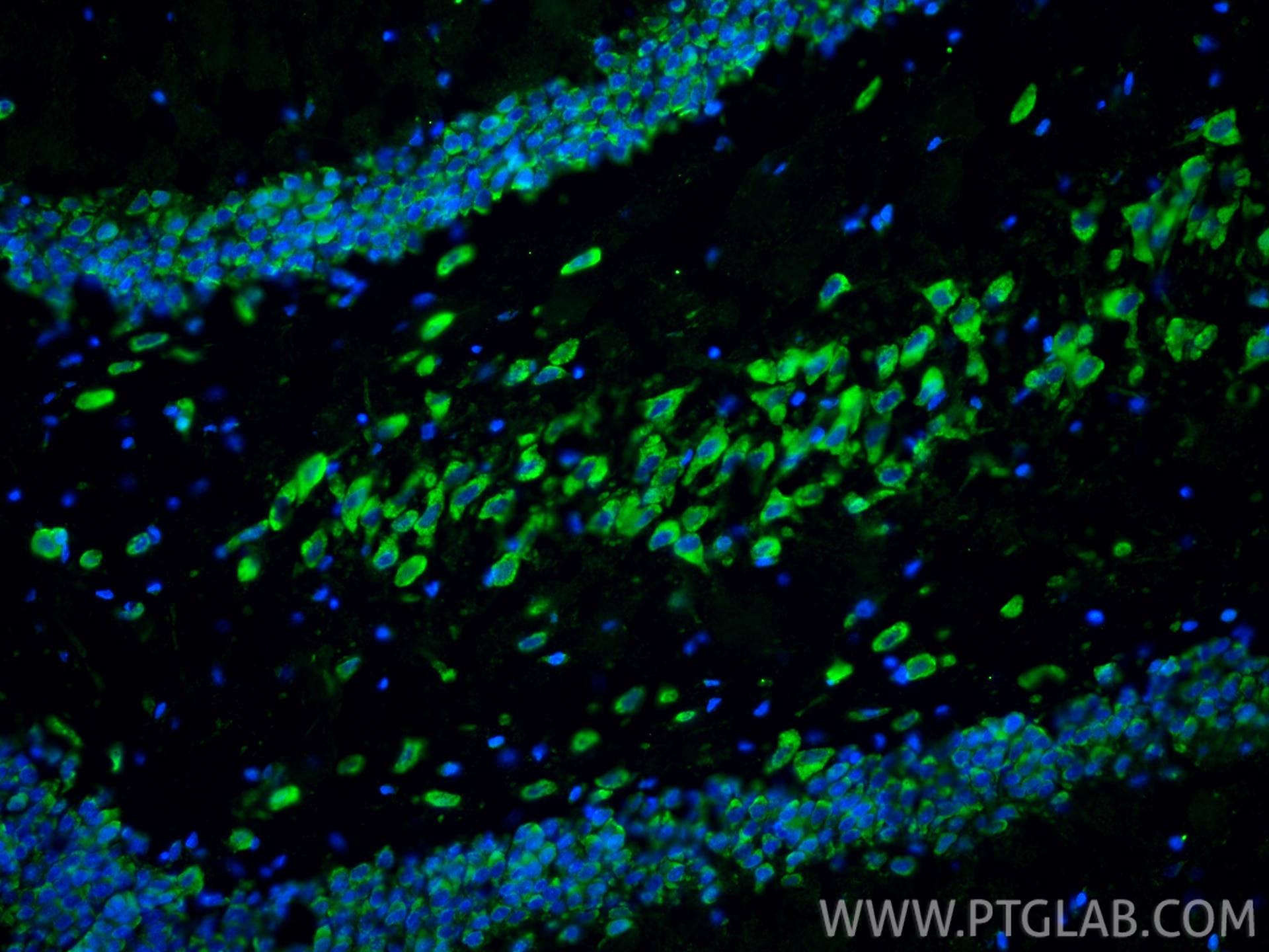Immunofluorescence (IF) / fluorescent staining of rat brain tissue using NMDAR2A/GRIN2A Polyclonal antibody (28571-1-AP)