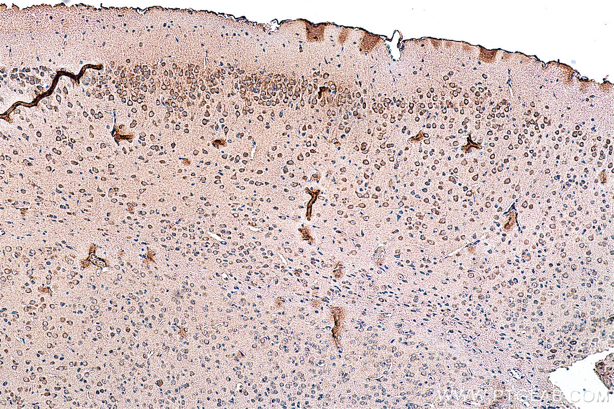 Immunohistochemistry (IHC) staining of mouse brain tissue using NMDAR2A/GRIN2A Polyclonal antibody (28571-1-AP)