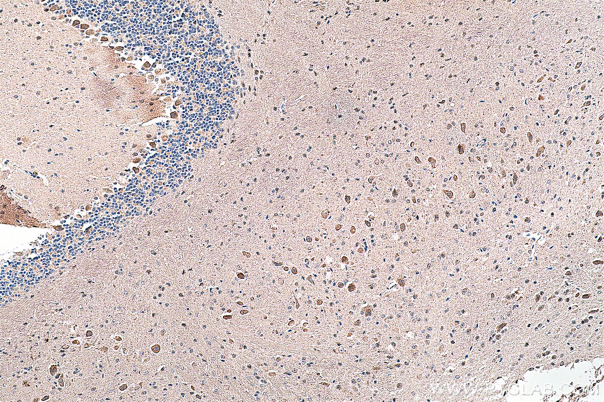 Immunohistochemistry (IHC) staining of mouse cerebellum tissue using NMDAR2A/GRIN2A Polyclonal antibody (28571-1-AP)