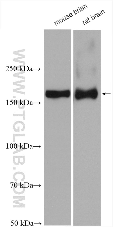 Western Blot (WB) analysis of various lysates using NMDAR2A/GRIN2A Polyclonal antibody (28571-1-AP)