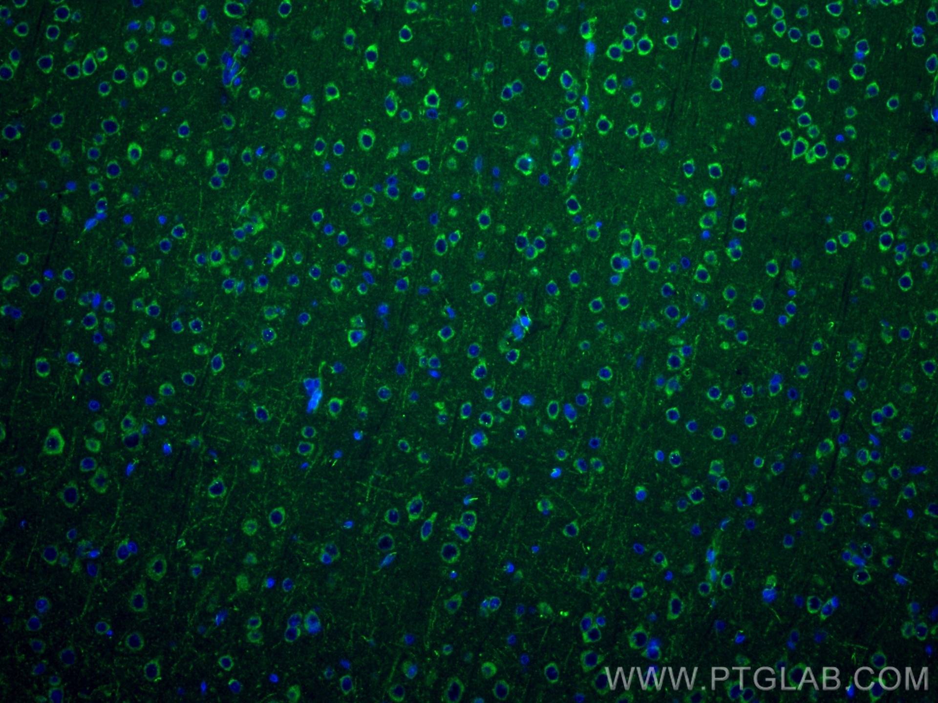 Immunofluorescence (IF) / fluorescent staining of rat brain tissue using NMDAR2A/GRIN2A Recombinant antibody (83465-2-RR)