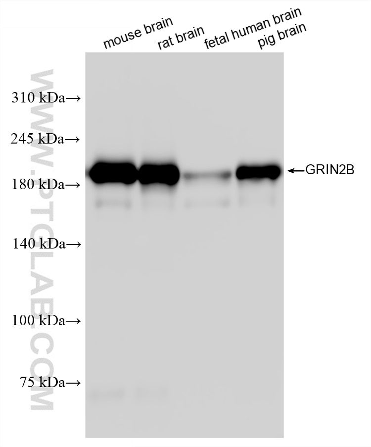 Western Blot (WB) analysis of various lysates using NMDAR2B/GRIN2B Recombinant monoclonal antibody (88068-1-RR)