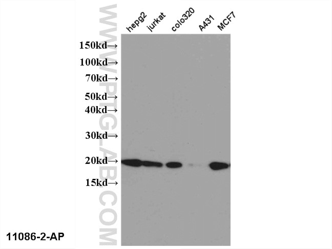Western Blot (WB) analysis of multi-cells using NME1 Polyclonal antibody (11086-2-AP)