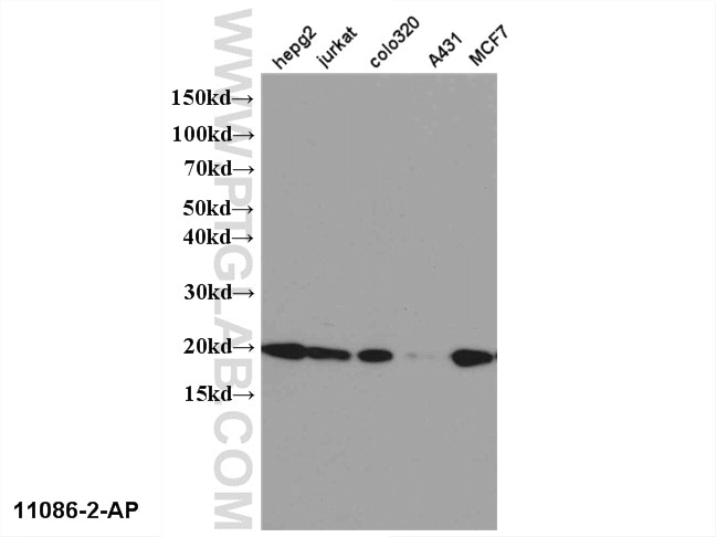 WB analysis of multi-cells using 11086-2-AP