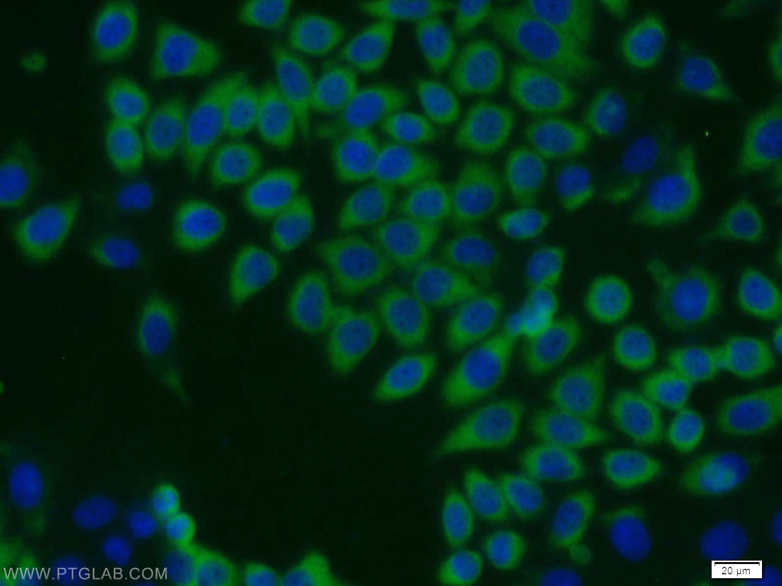 Immunofluorescence (IF) / fluorescent staining of MCF-7 cells using NME1 Polyclonal antibody (11086-2-AP)