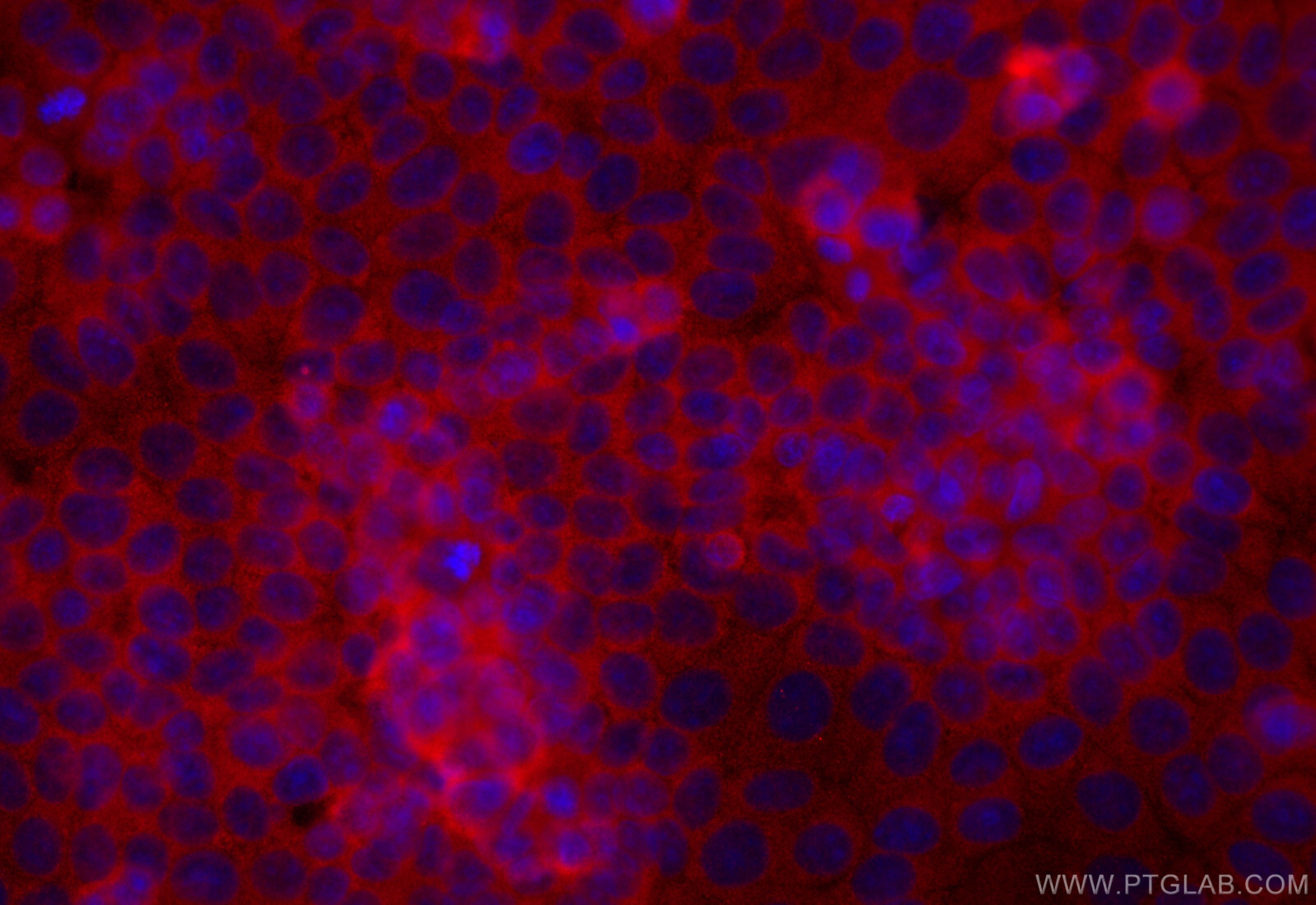 Immunofluorescence (IF) / fluorescent staining of MCF-7 cells using NME1 Polyclonal antibody (11086-2-AP)