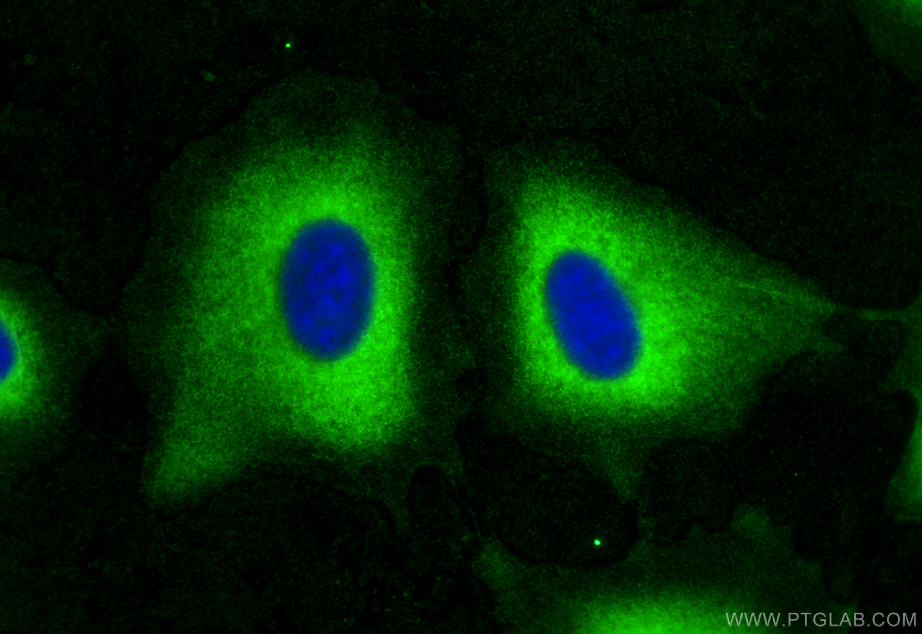 Immunofluorescence (IF) / fluorescent staining of A549 cells using NME1 Polyclonal antibody (11086-2-AP)