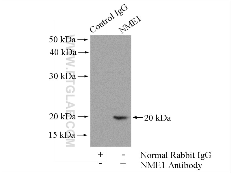 Immunoprecipitation (IP) experiment of A549 cells using NME1 Polyclonal antibody (11086-2-AP)