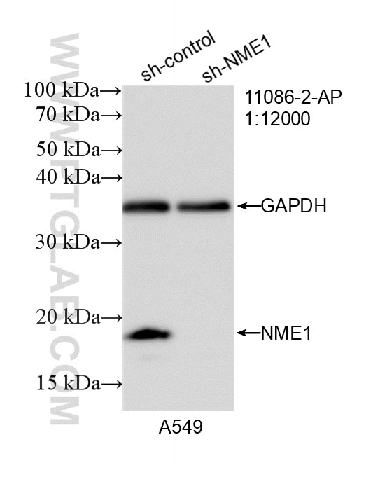 Western Blot (WB) analysis of A549 cells using NME1 Polyclonal antibody (11086-2-AP)