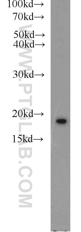 Western Blot (WB) analysis of HeLa cells using NME1 Polyclonal antibody (11086-2-AP)