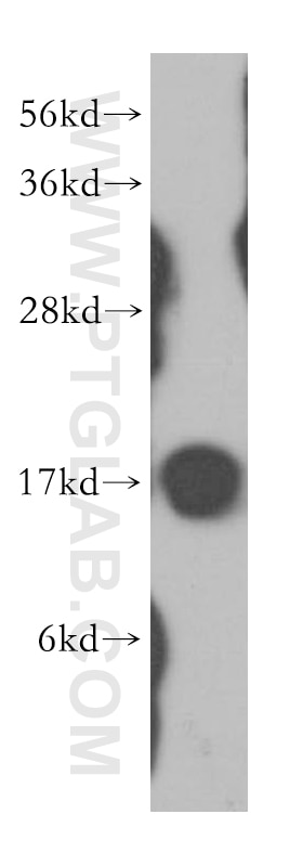 Western Blot (WB) analysis of MCF-7 cells using NME1 Polyclonal antibody (11086-2-AP)