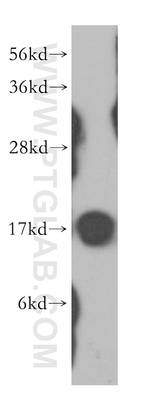 WB analysis of MCF-7 using 11086-2-AP