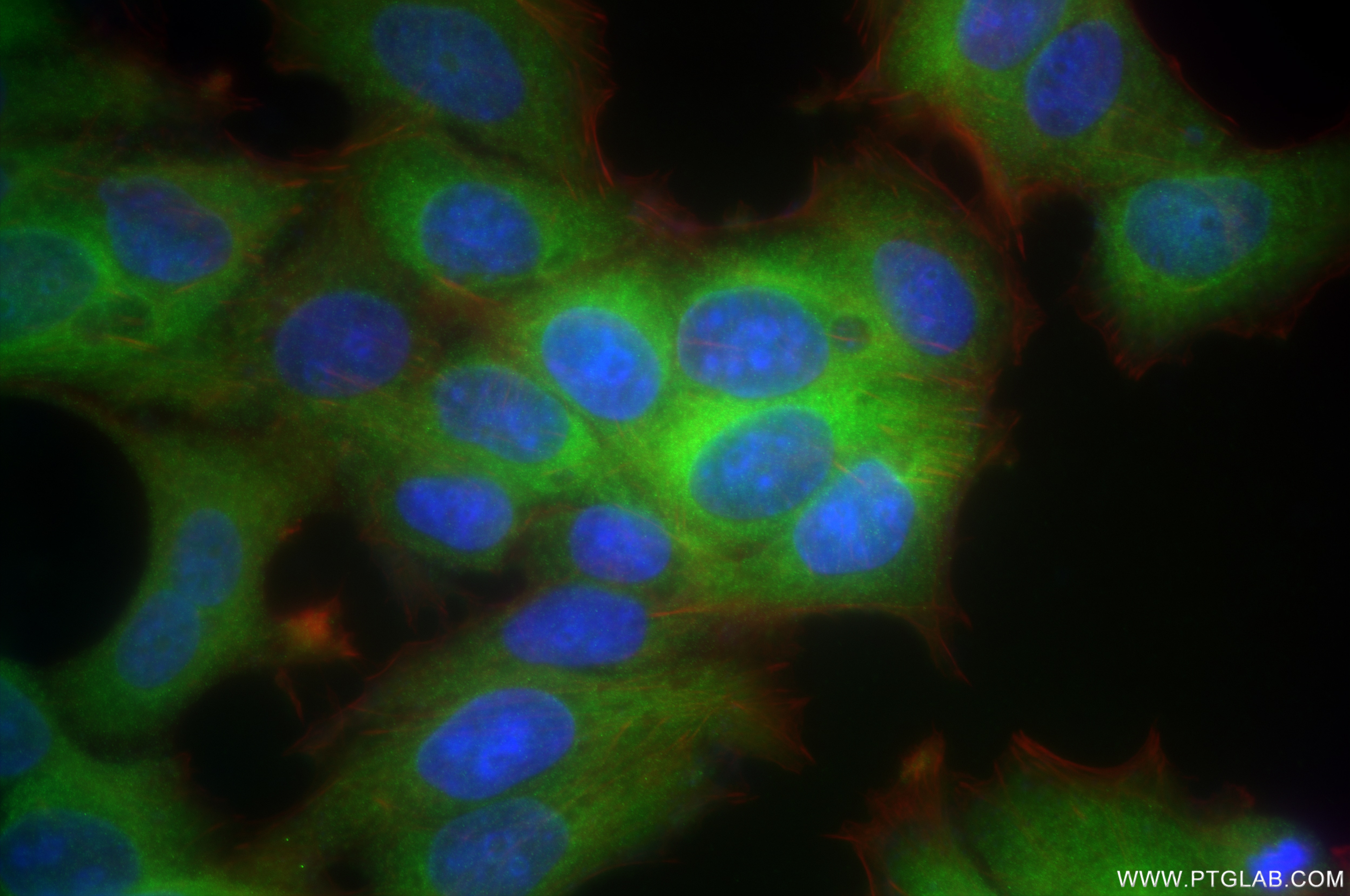 Immunofluorescence (IF) / fluorescent staining of MCF-7 cells using NME1 Recombinant antibody (85038-7-RR)