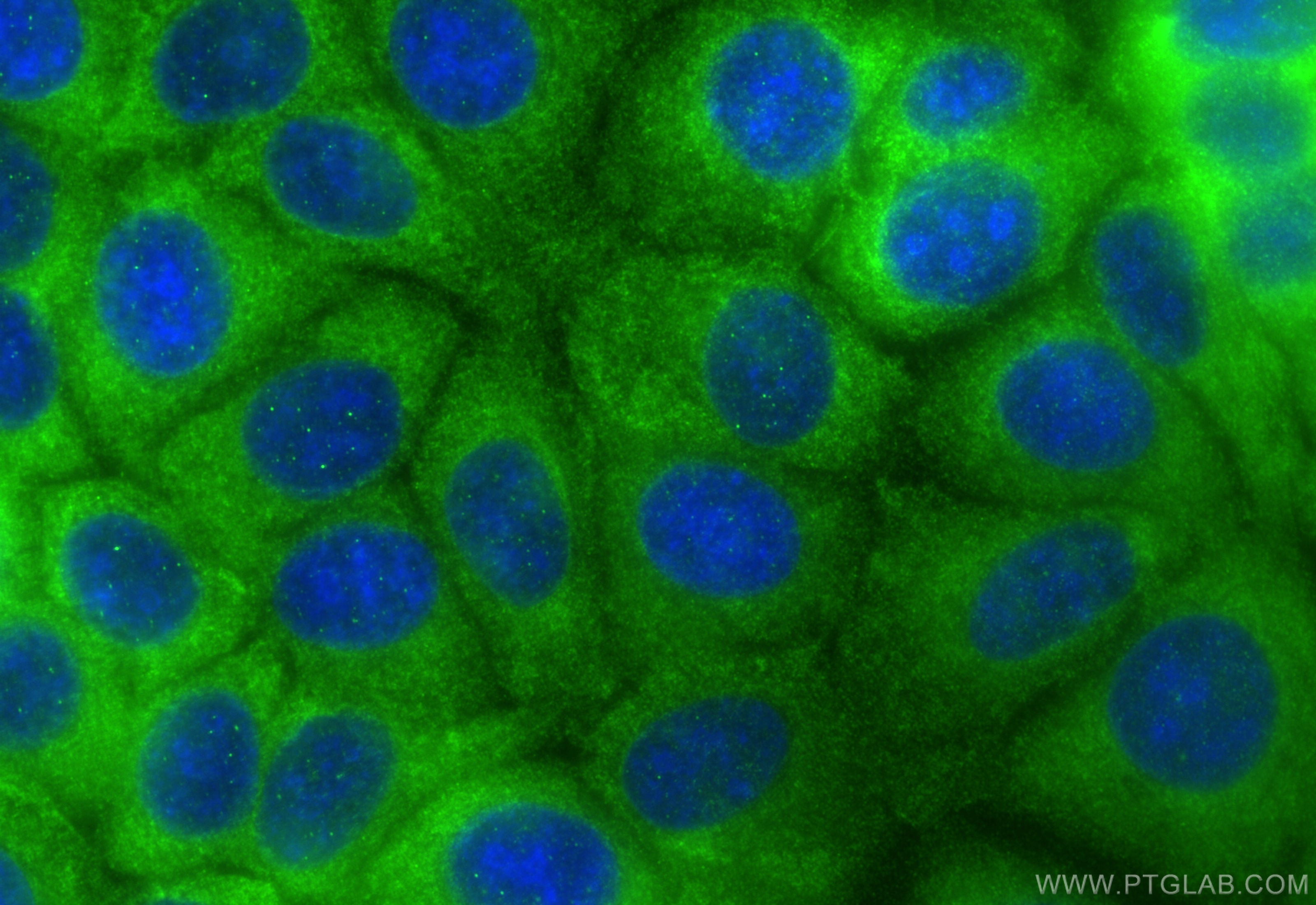 Immunofluorescence (IF) / fluorescent staining of MCF-7 cells using NME1 Recombinant antibody (85038-7-RR)