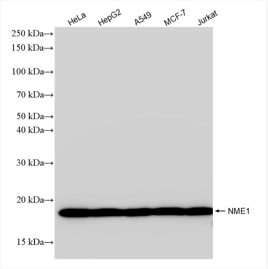 Western Blot (WB) analysis of various lysates using NME1 Recombinant antibody (85038-7-RR)