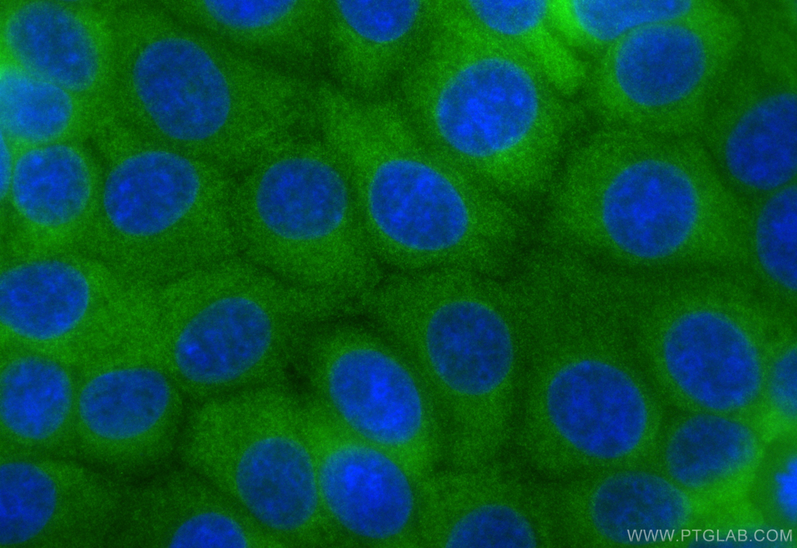 Immunofluorescence (IF) / fluorescent staining of MCF-7 cells using CoraLite® Plus 488-conjugated NME1 Recombinant ant (CL488-85038-7)