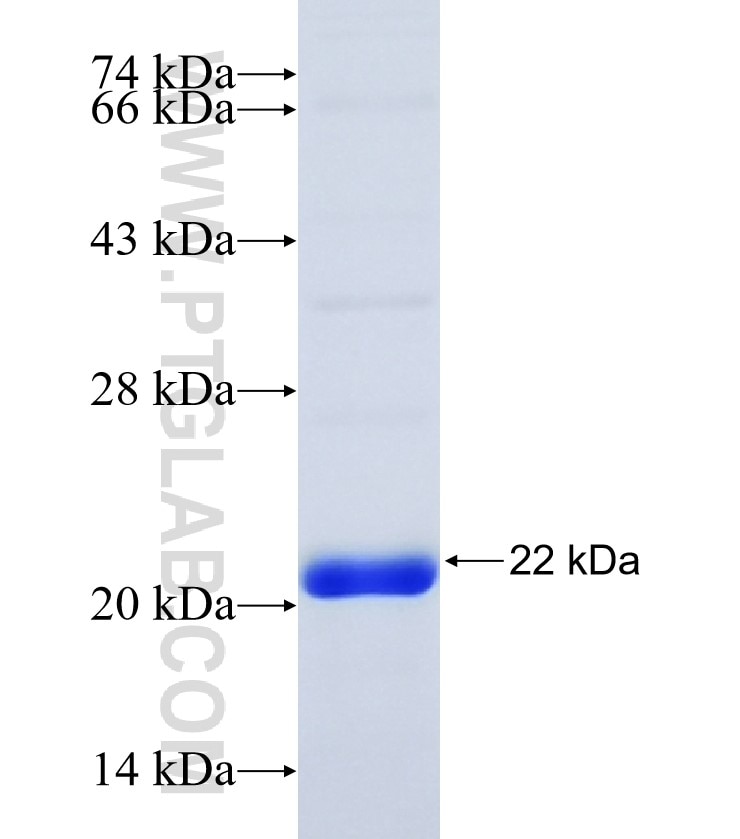 NME1 fusion protein Ag28529 SDS-PAGE
