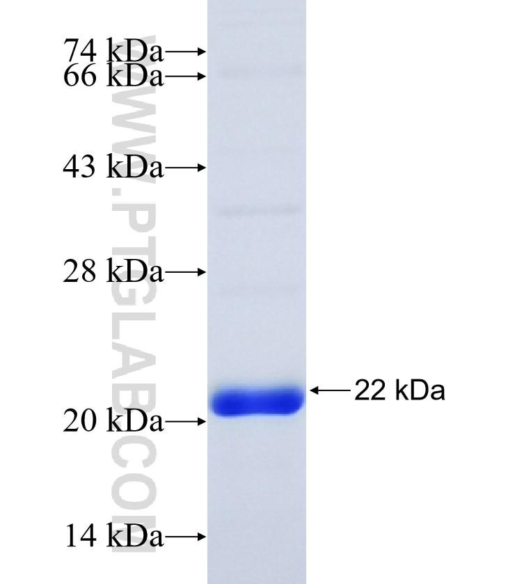 NME1 fusion protein Ag28529 SDS-PAGE