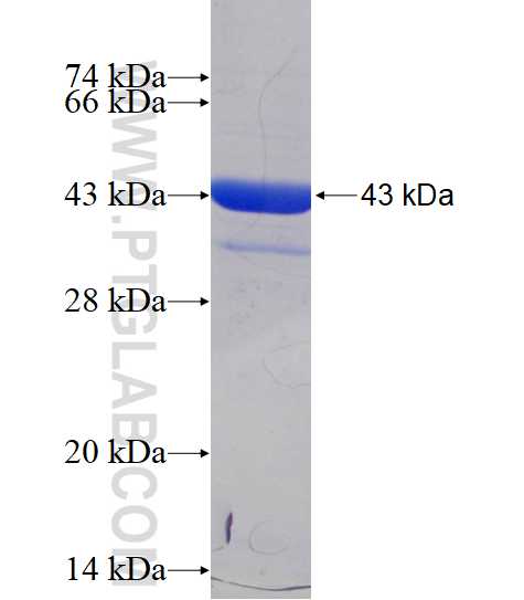 NME1 fusion protein Ag1548 SDS-PAGE