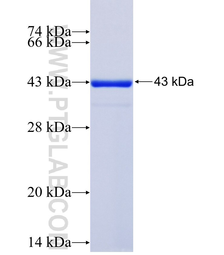 NME1 fusion protein Ag1548 SDS-PAGE