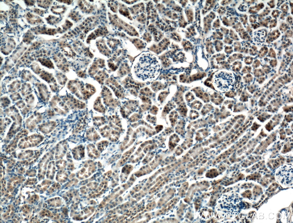 Immunohistochemistry (IHC) staining of mouse kidney tissue using NME2 Polyclonal antibody (20493-1-AP)