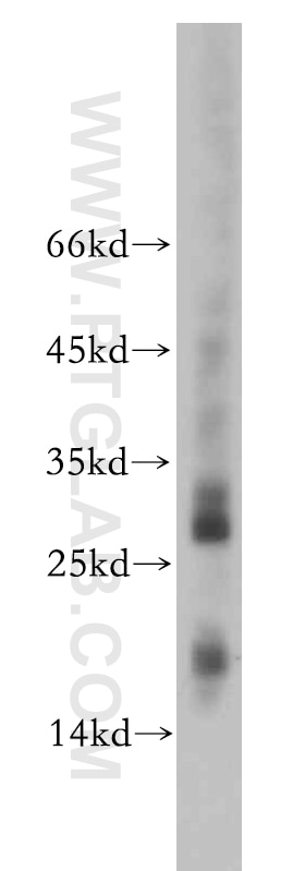 Western Blot (WB) analysis of Jurkat cells using NME2 Polyclonal antibody (20493-1-AP)