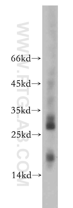 WB analysis of Jurkat using 20493-1-AP