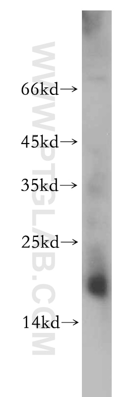 WB analysis of mouse kidney using 20493-1-AP