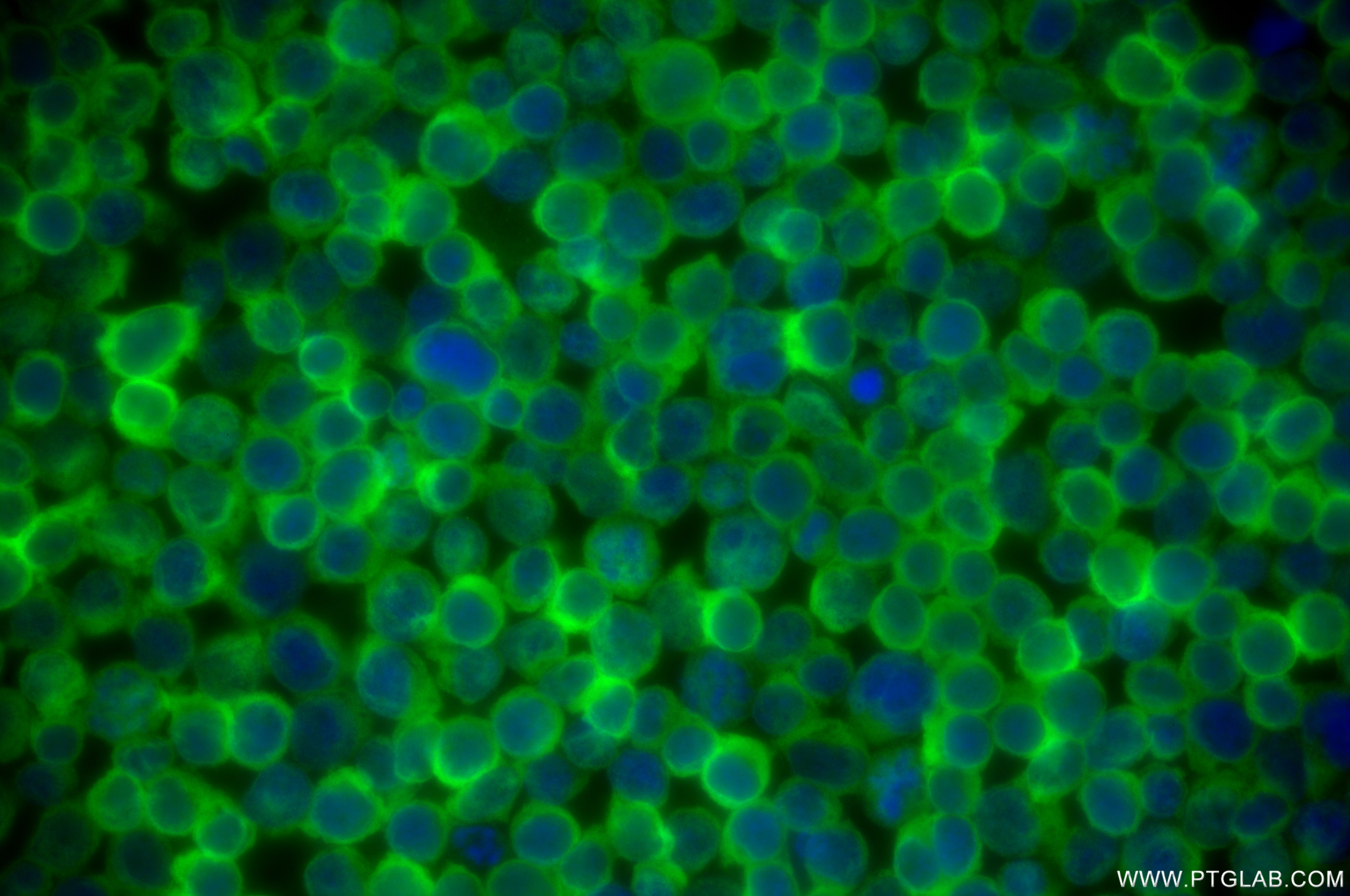 Immunofluorescence (IF) / fluorescent staining of Jurkat cells using NME2 Recombinant antibody (85074-4-RR)