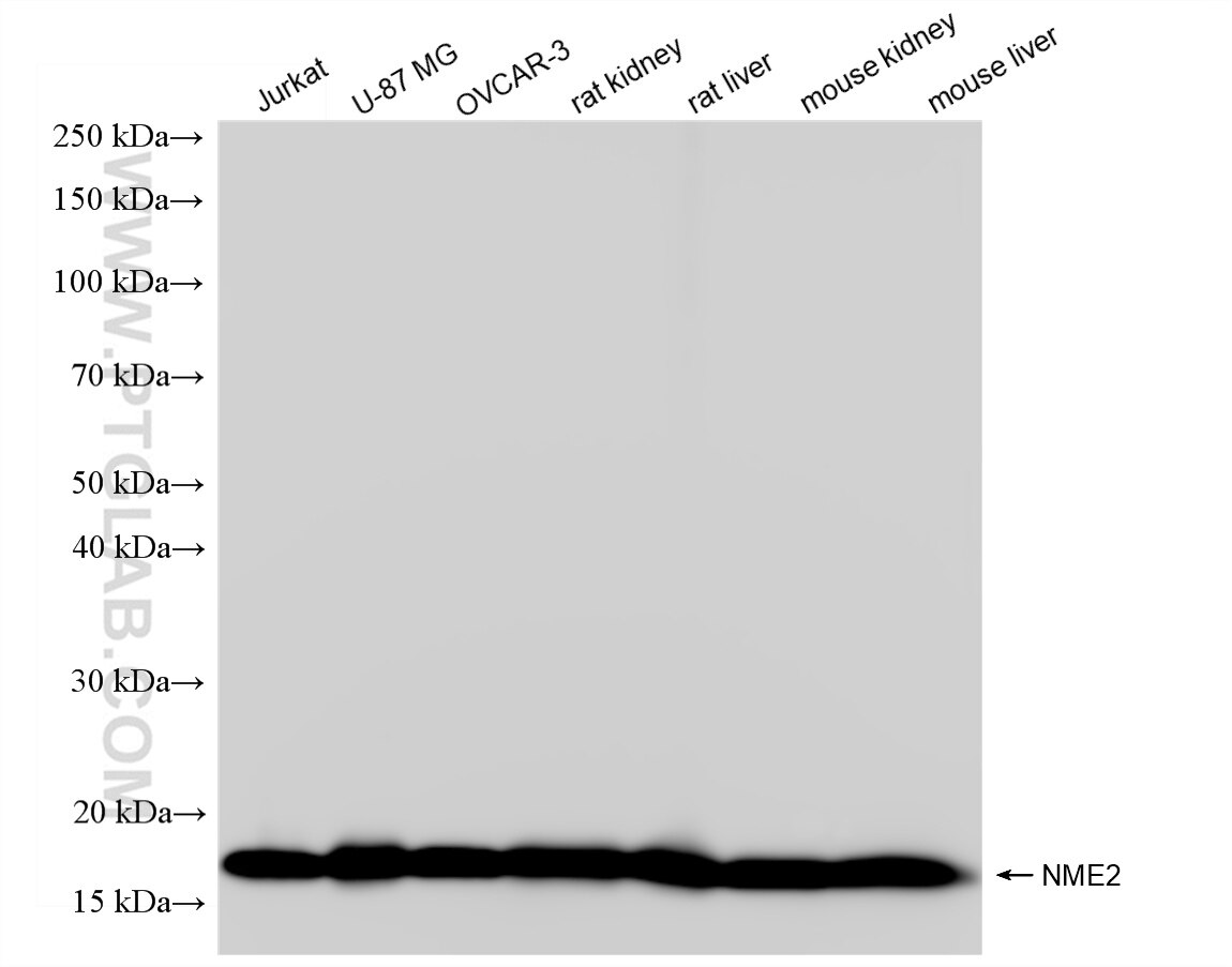 Western Blot (WB) analysis of various lysates using NME2 Recombinant antibody (85074-4-RR)