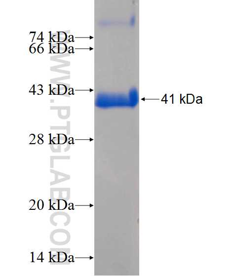 NME2 fusion protein Ag13913 SDS-PAGE
