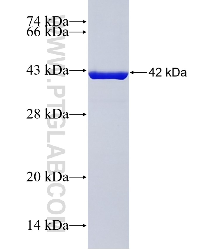 NME2 fusion protein Ag13913 SDS-PAGE