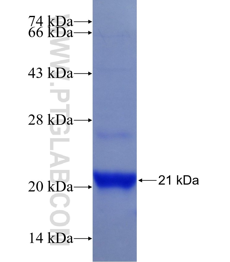 NME2 fusion protein Ag14037 SDS-PAGE