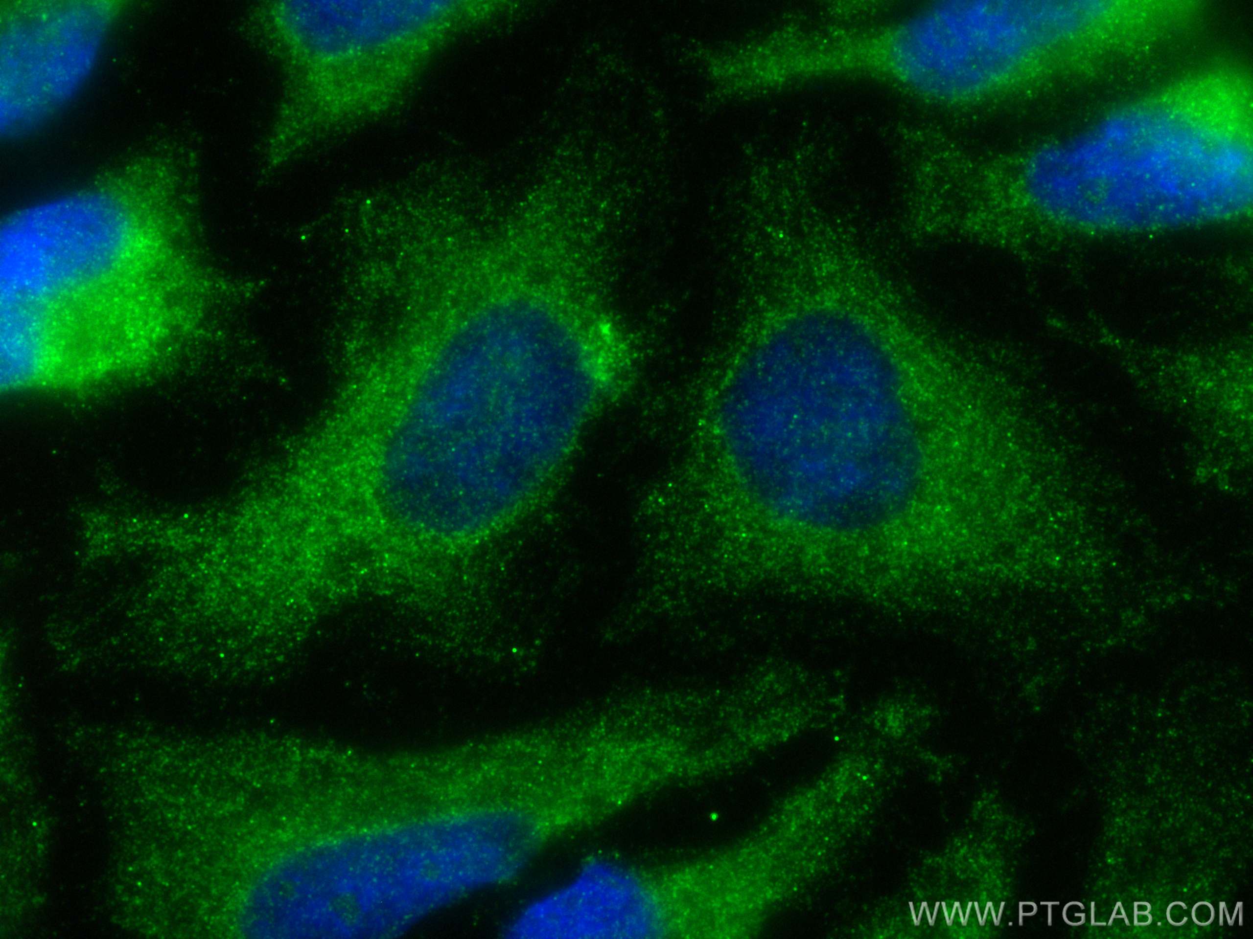 Immunofluorescence (IF) / fluorescent staining of HeLa cells using NME3 Polyclonal antibody (15136-1-AP)