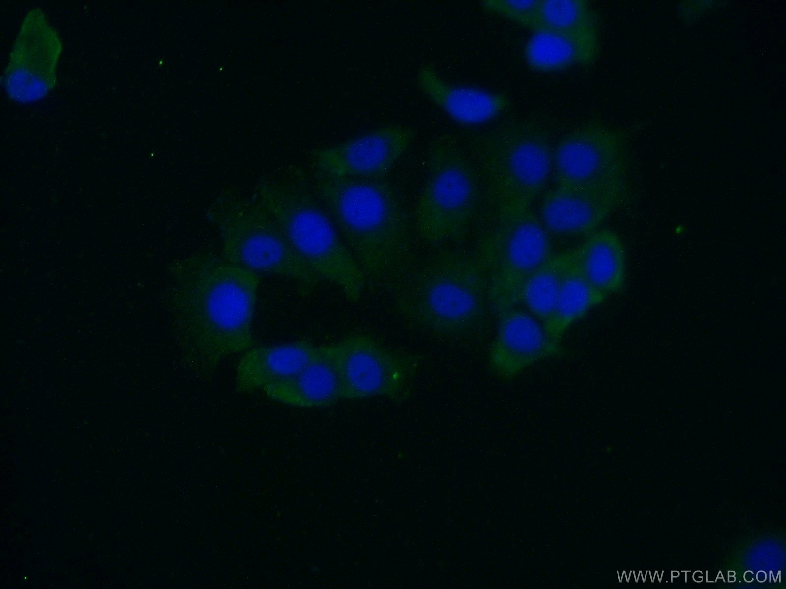 Immunofluorescence (IF) / fluorescent staining of MCF-7 cells using NME3 Polyclonal antibody (15136-1-AP)