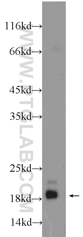Western Blot (WB) analysis of MCF-7 cells using NME3 Polyclonal antibody (15136-1-AP)